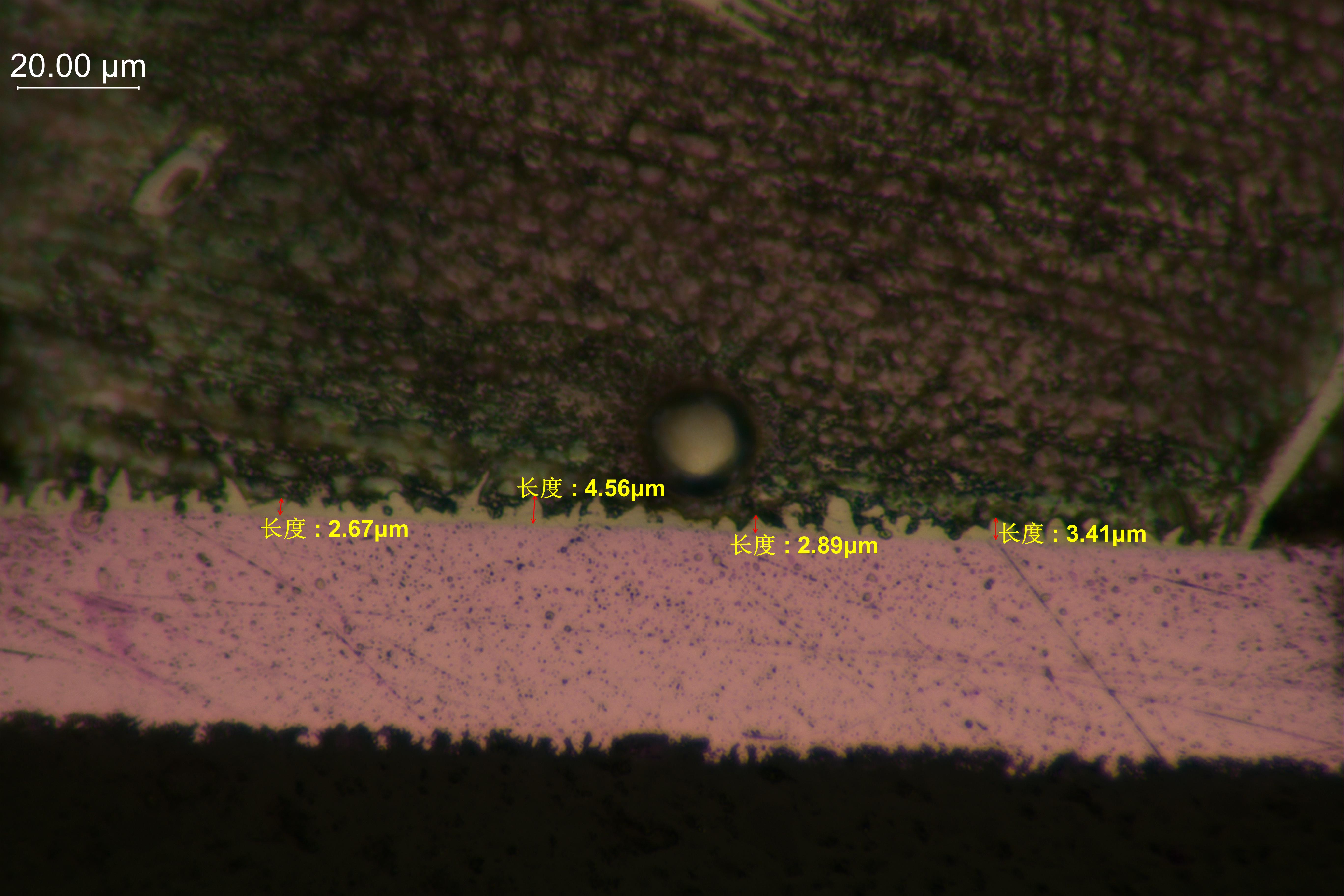 ���þ��취�۲� IMC ��̳�